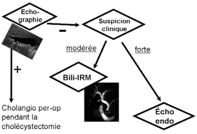 Stratégie « théorique » d’exploration d’un patient symptomatique, suspect de migration ou d’obstruction lithiasique