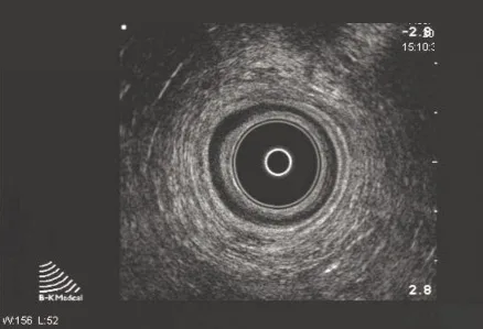 Figure 2. Coupe au niveau du muscle pubo-rectal