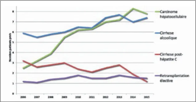 Figure 4. Indications de transplantations hépatiques en France en 2015. Le CHC est désormais la première cause d’inscription sur liste de transplantation hépatique (29,6 % des indications de greffe) après les cirrhoses décompensées liées à l’alcool (http://www.agence-biomedecine.fr/)