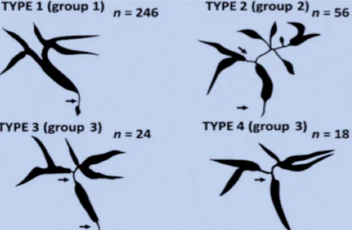 Figure 10. Différents types cholangiographiques d’atteinte biliaire de la cholangite à IgG4