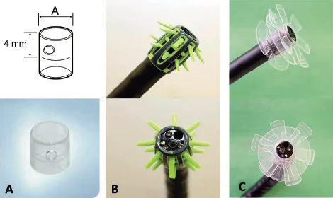 Figure 4. Coloscopie assistée par capuchon. A : capuchon transparent, B : capuchon Endocuff®, C : capuchon Endoring®