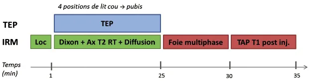 Figure 2. Proposition d’un protocole d’exploration pour les bilans de récidives de cancers colorectaux. Loc : séquence Localizer de l’IRM. Ax T2 RT : Coupes axiales en pondération T2 avec synchronisation respiratoire. TAP : thoraco-abdomino-pelvien