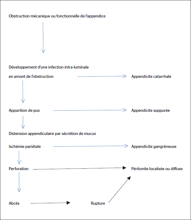 Figure 2. Physiopathologie classique de l’appendicite aiguë