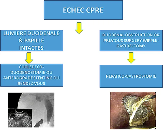Figure 3. Arbre décisionnel
