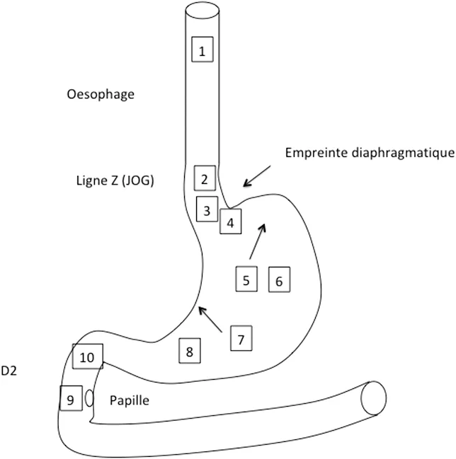 Figure 1. Iconographie préconisée par les recommandations de l’ESGE