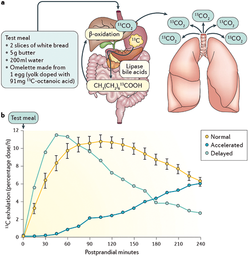 Figure 3 : Vidange gastrique par test respiratoire à l’acide octanoïque marqué au 13C (14)