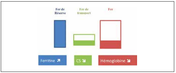 L’inflammation stimule la synthèse de l’hepcidine avec blocage de la ferroportine, blocage de l’absorption intestinale du fer et séquestration du fer dans les réserves aboutissant à une diminution de l’érythropoïèse