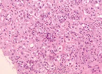 B - Fort grossissement x 40