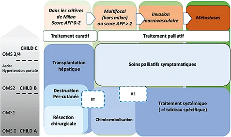Figure 1 : Stratégie thérapeutique dans le carcinome hépatocellulaire selon le Thésaurus National de Cancérologie Digestive, TNCD juin 2021