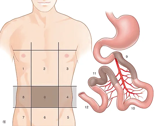 Figure 1 : Index péritonéal définissant précisément l’étendue de la carcinose