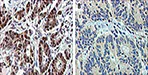 Immunohistochimie