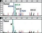 Polymerase Chain Reaction (PCR)