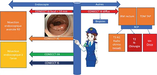 Figure 3 : Rôle d’aiguillage de l’endoscopiste devant une néoplasie colorectale