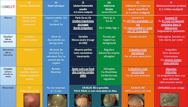 Figure 8 : rappel de la classification CONECCT reliant les classifications existantes