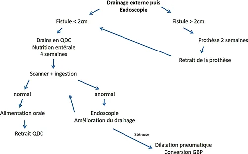 Figure 3 : algorithme résumant la prise en charge des fistules après SG