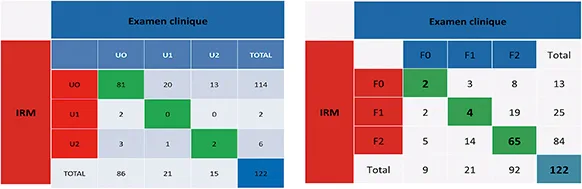 Figure 3 : Analyse comparative du classement de sévérité des ulcérations et des fistules anales de Crohn selon qu’il soit réalisé par un simple examen clinique ou lors d’une exploration IRM (17)