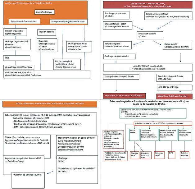 Figure 9 : Arbres décisionnels édité par la Société Nationale Française de Colo-Proctologie (SNFCP) en 2021 pour le traitement des fistules périnéales dans le cadre d’une maladie de Crohn (Accord d’expert)