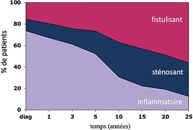 Figure 1 : Histoire naturelle de la MC