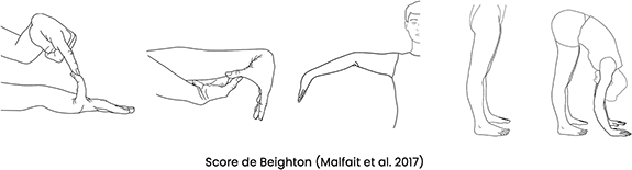 Figure 1 : Manœuvre pour calculer le score de Begihton