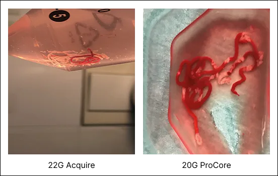 Figure 6 : Macroscopic On-Site Evaluation (MOSE)