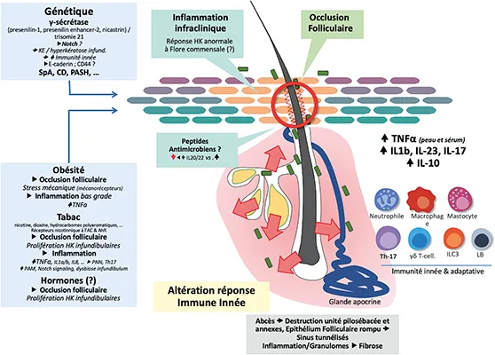 Figure 2 : Physiopathogénie de la maladie de Verneuil