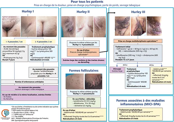 Figure 3 : Algorithme de recommandations de prise en charge de l’hidradénite suppurée, Centre de Preuves en Dermatologie (sfdermato.org)