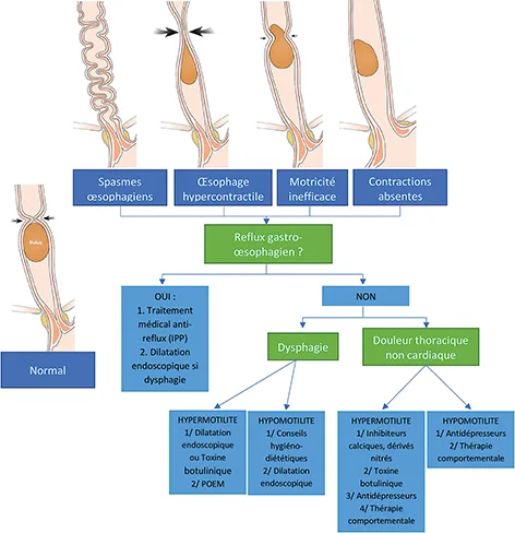 Figure 2 : Options thérapeutiques hors obstruction de la jonction œso-gastrique