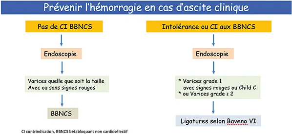 Prévenir l’hémorragie en cas d’ascite décompensée