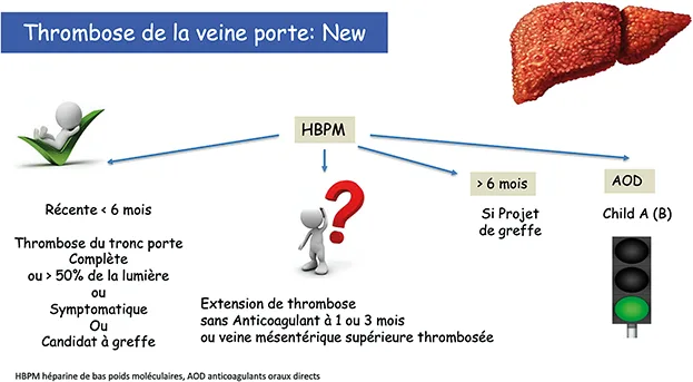 Thrombose de la veine porte et cirrhose
