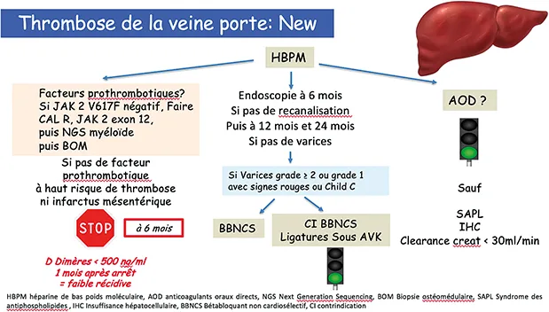 Thrombose de la veine porte sans cirrhose