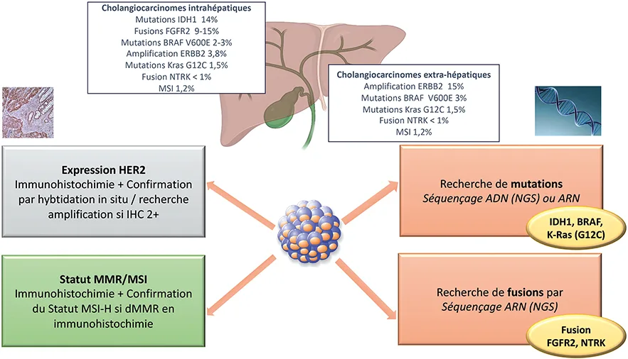 Figure 3 : Portrait moléculaire des cholangiocarcinomes. Fréquences des anomalies moléculaires actionnables à rechercher en première intention et modalités de recherche de ces anomalies