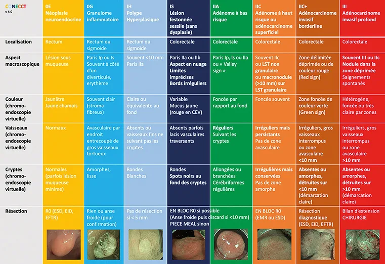 types de lésions colorectales fréquentes