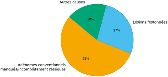 Figure 1 : Répartition globale des causes de CCRi