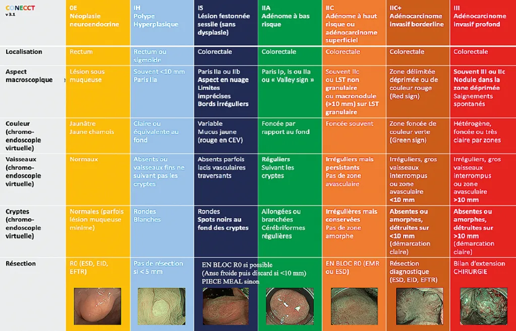 Figure 1 : Synthèse des classifications connues et validées