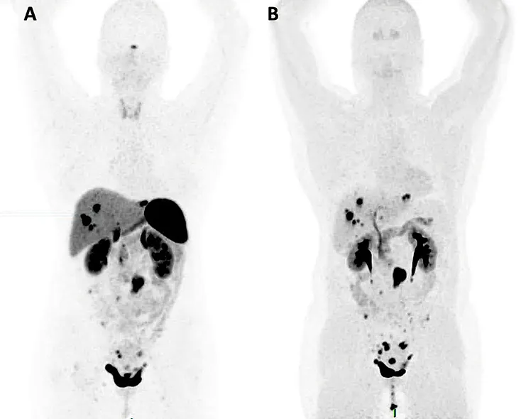 Figure 3 : Examens d’imagerie nucléaire du bilan d’extension des TNEG