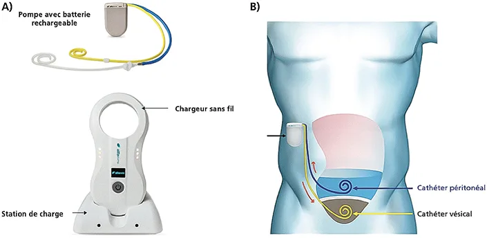 Figure 1 : ALFAPUMP