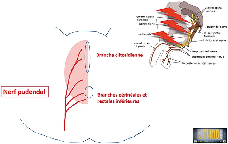 Figure 13 : zones ano-périnéales d’innervation du nerf pudendal d’après Pigot F (78)