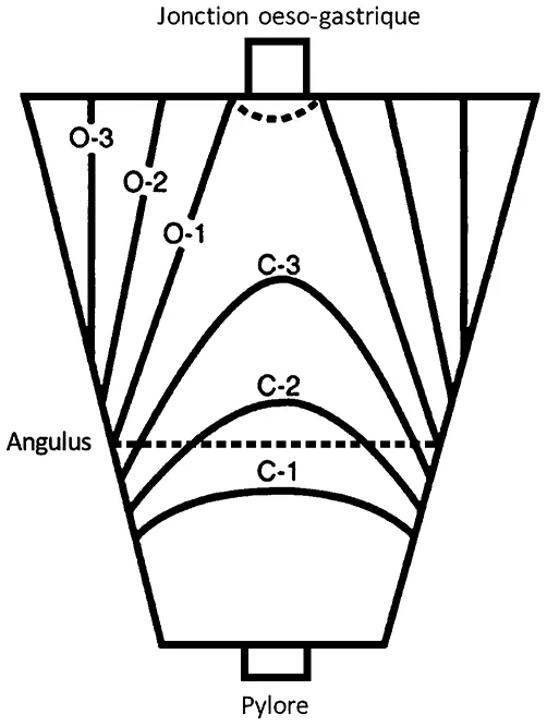 Figure 3 : Schématisation de la classification de Kimura-Takemoto, adapté de (15)