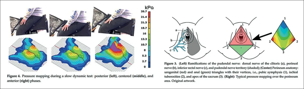 Figure 14 : répartitions des pressions sur le périnée féminin sur une selle (81)