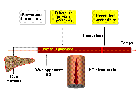 Différents types de prévention au cours de l’HTP