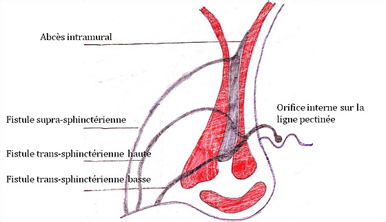 Figure 2 : Classification de Arnous